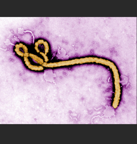 Ebola