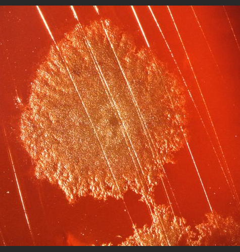 Clostridium Bacteria